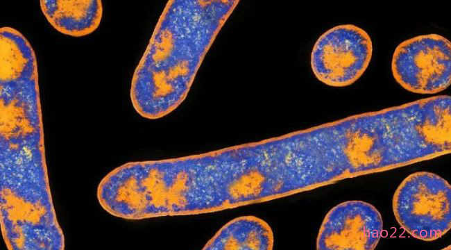 世界上最危险的10种细菌 结核分枝杆菌位居榜首 